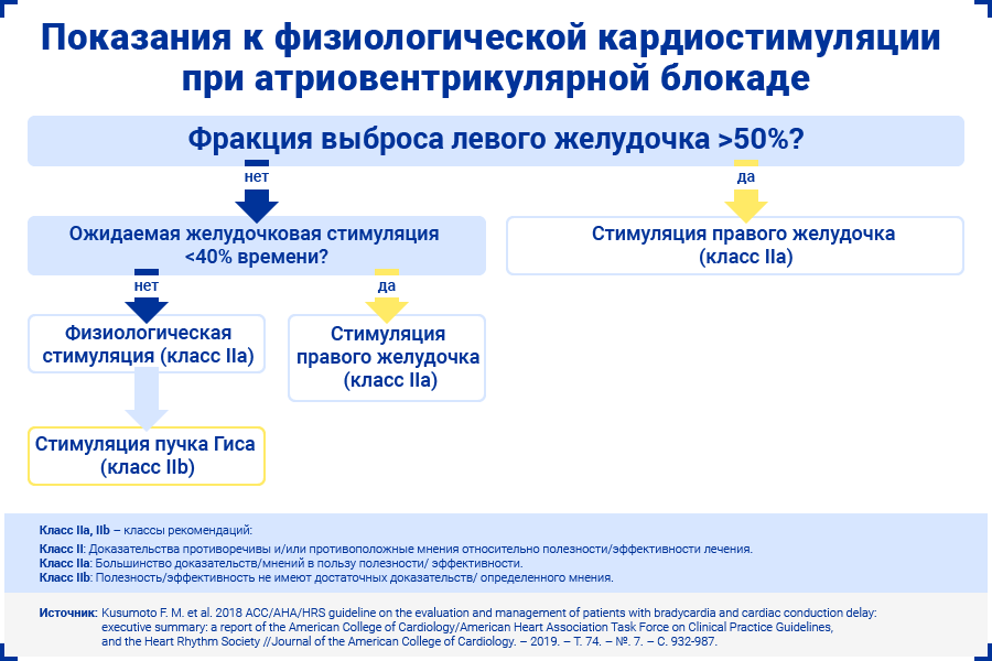 Показания к физиологической кардиостимуляции при атриовентрикулярной блокаде